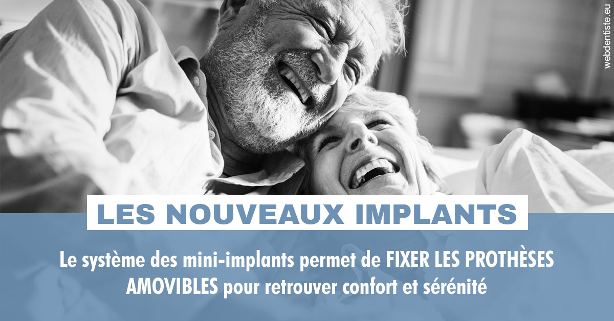 https://www.smileclinique83.fr/Les nouveaux implants 2