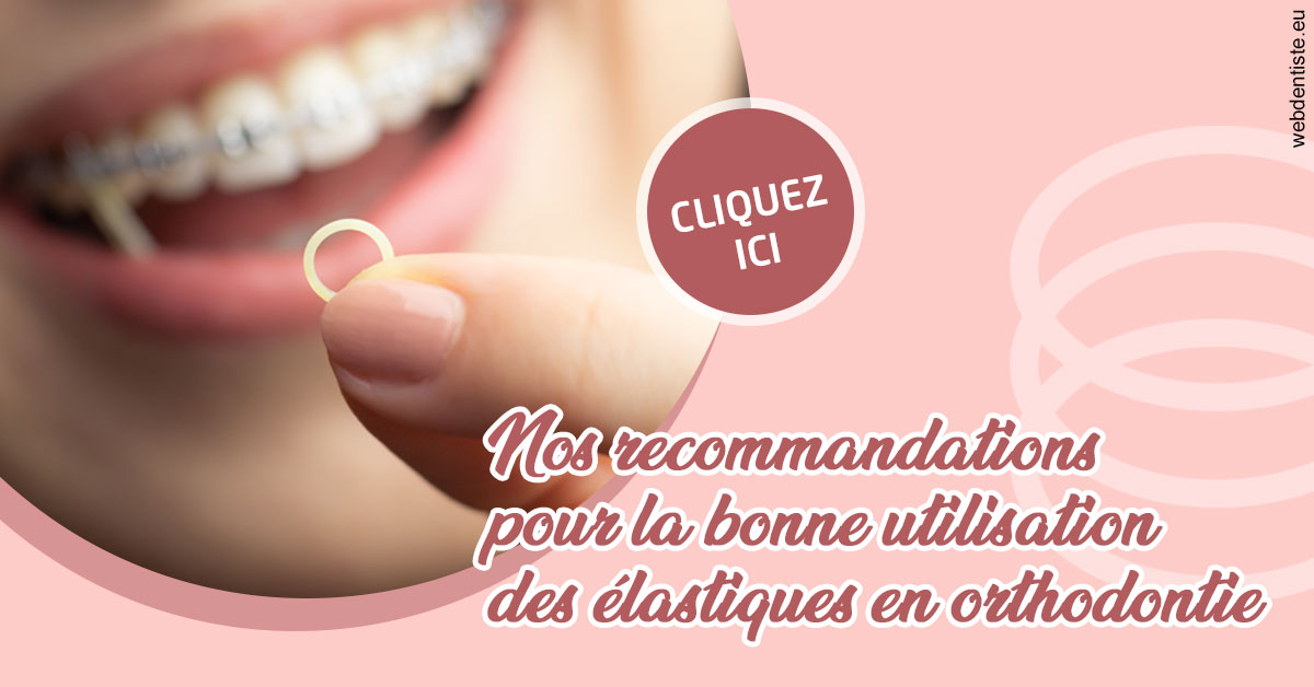 https://www.smileclinique83.fr/Elastiques orthodontie 1