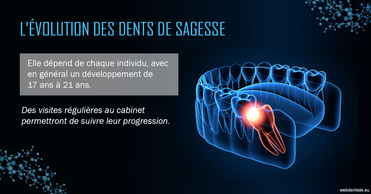 https://www.smileclinique83.fr/2023 T4 - Dents de sagesse 01
