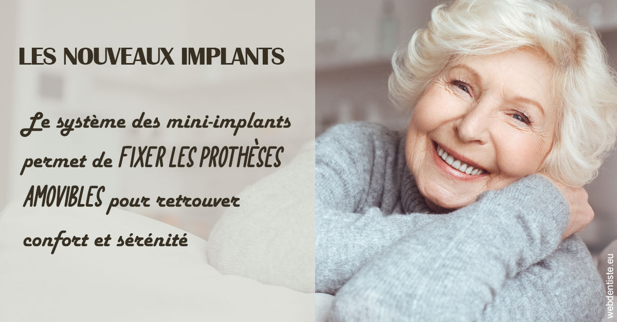https://www.smileclinique83.fr/Les nouveaux implants 1