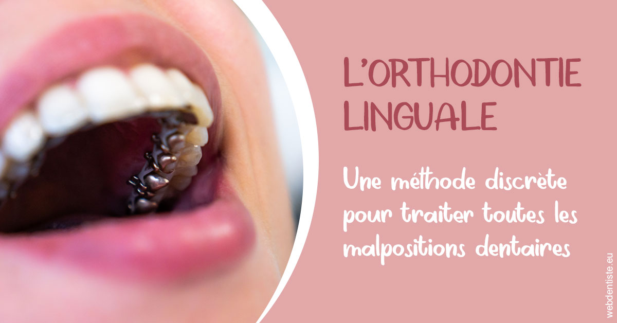 https://www.smileclinique83.fr/L'orthodontie linguale 2