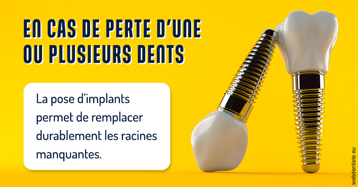 https://www.smileclinique83.fr/2024 T1 - Implants 02