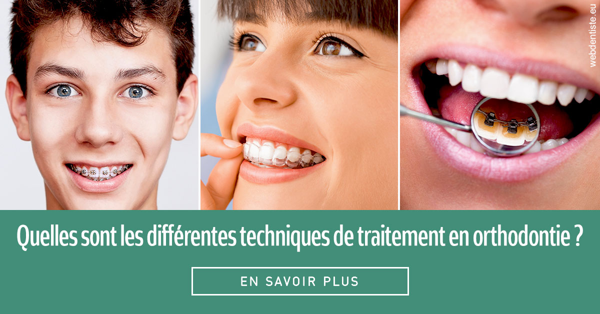 https://www.smileclinique83.fr/Les différentes techniques de traitement 2