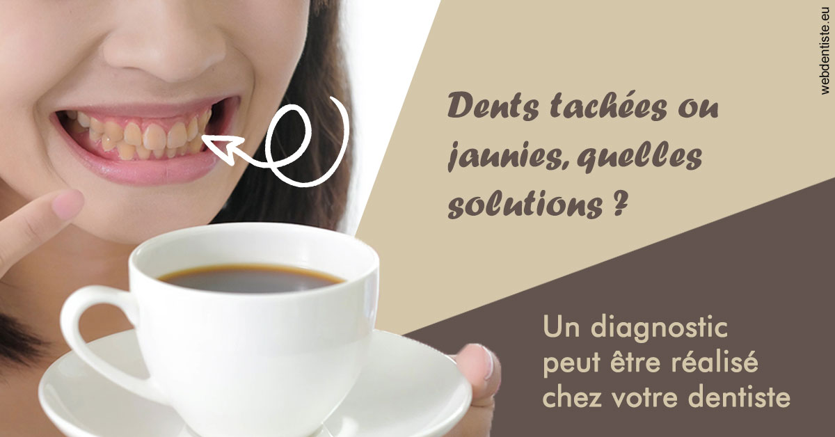 https://www.smileclinique83.fr/Dents tachées 1