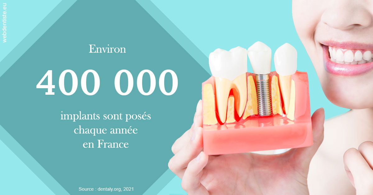 https://www.smileclinique83.fr/Pose d'implants en France 2