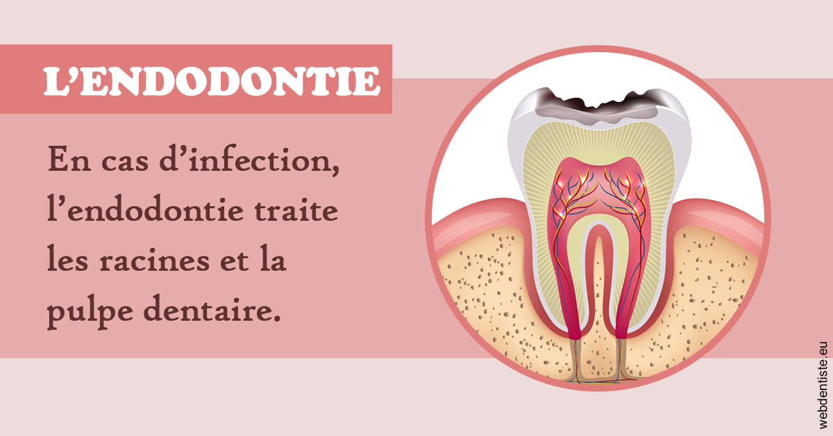 https://www.smileclinique83.fr/L'endodontie 2
