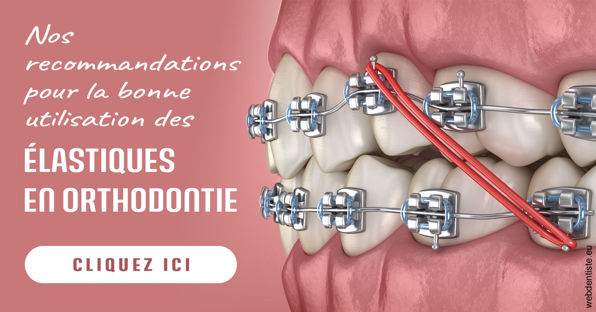 https://www.smileclinique83.fr/Elastiques orthodontie 2